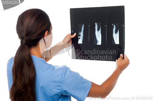 Image of Female doctor looking at patient's x-ray report