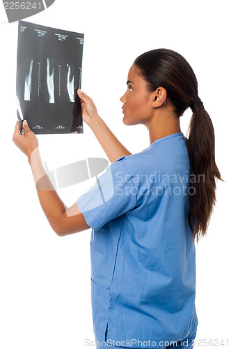 Image of Young doctor looking at scanned x-ray report