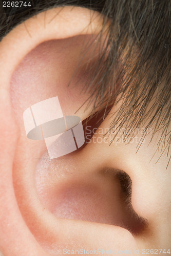 Image of Human ear