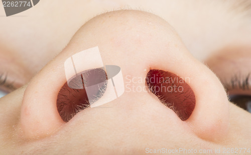 Image of Human nose