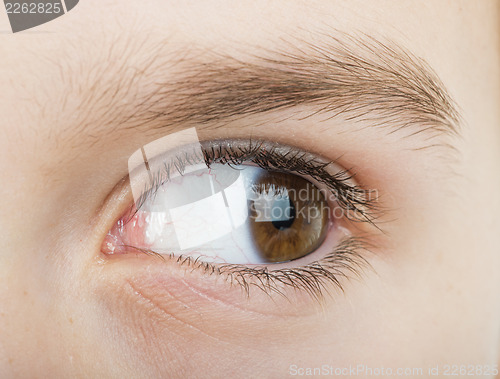 Image of Human eye looking to the right