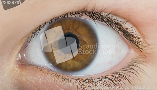 Image of Human eye brown color