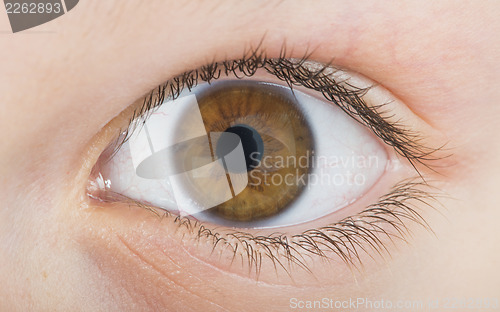 Image of Human eye brown color