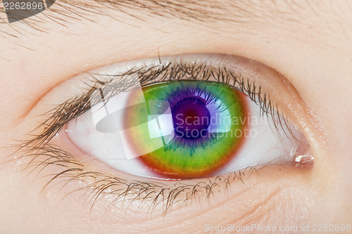 Image of Human eye