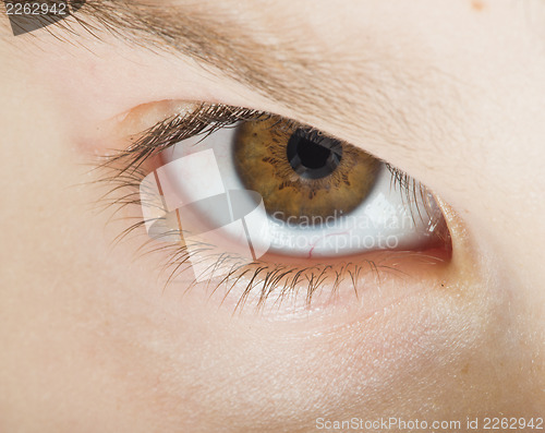 Image of Human eye brown color
