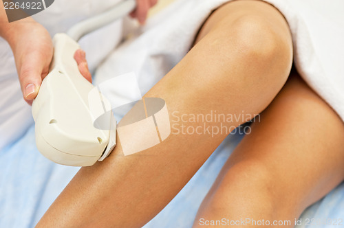 Image of laser epilation