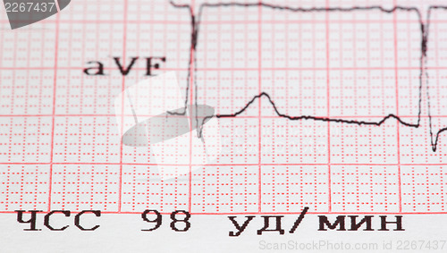 Image of cardiogram