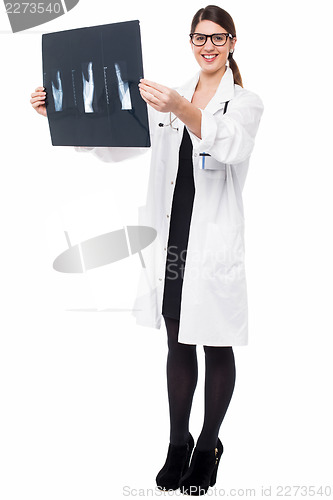 Image of Female doctor reviewing patient's x-ray report