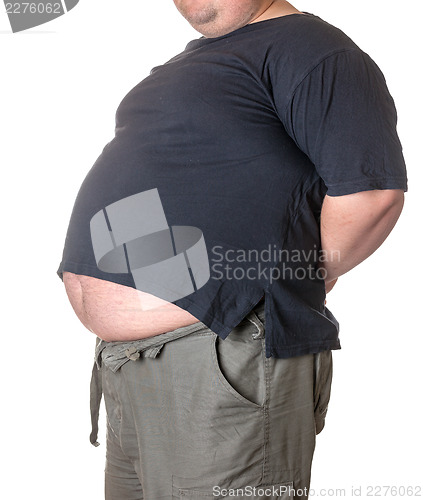 Image of Fat man with a big belly