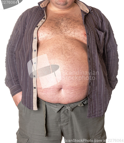 Image of Fat man with a big belly