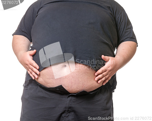 Image of Fat man with a big belly