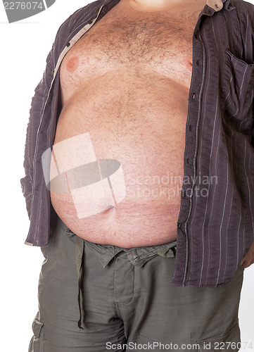 Image of Fat man with a big belly