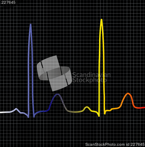 Image of black ecg