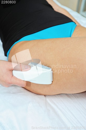 Image of procedure
