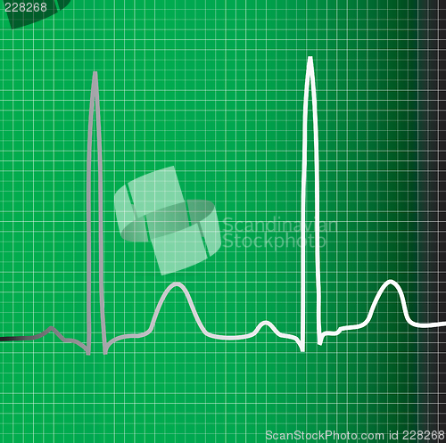 Image of green ecg