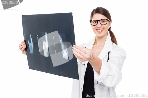 Image of Female doctor holding up x-ray sheet