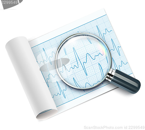 Image of Cardiogram 