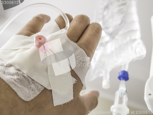 Image of Hand with infusion bag