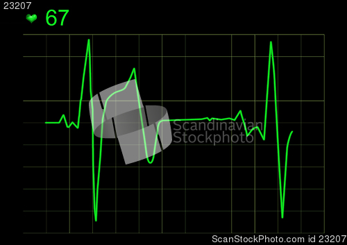 Image of  ECG graph