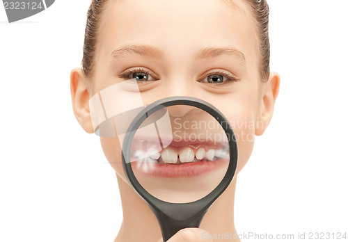 Image of teenage girl with magnifying glass showing teeth