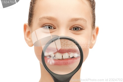 Image of teenage girl with magnifying glass showing teeth