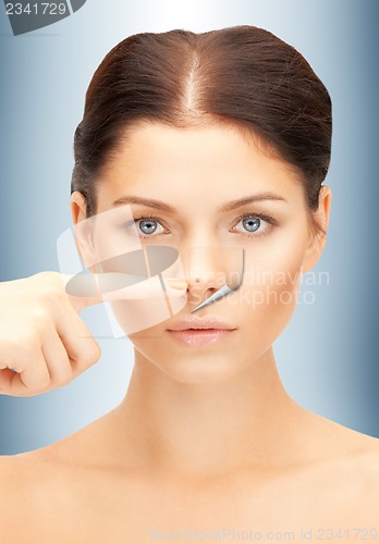 Image of no more acne