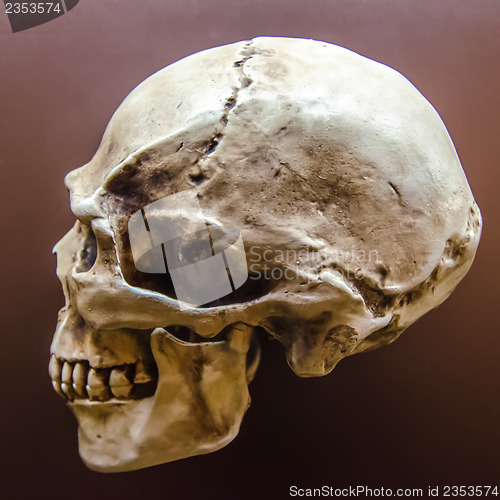 Image of Side profile view of human skull  