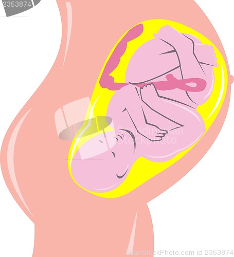 Image of human fetus inside womb