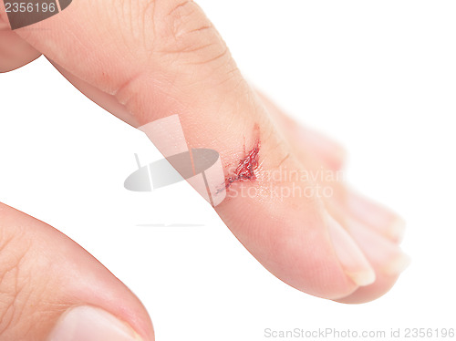 Image of wound with blood