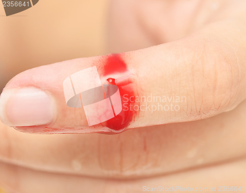 Image of wound with blood