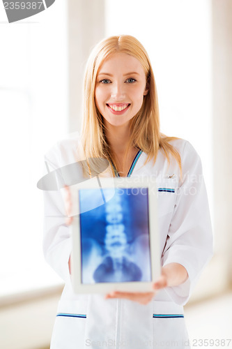 Image of female doctor with x-ray on tablet pc