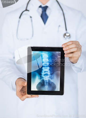 Image of male doctor holding tablet pc with x-ray
