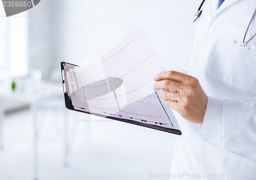 Image of male doctor hands holding cardiogram