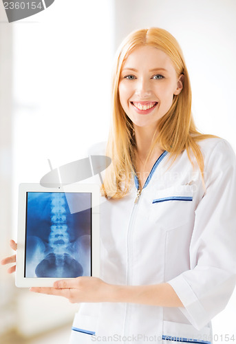 Image of female doctor with x-ray on tablet pc