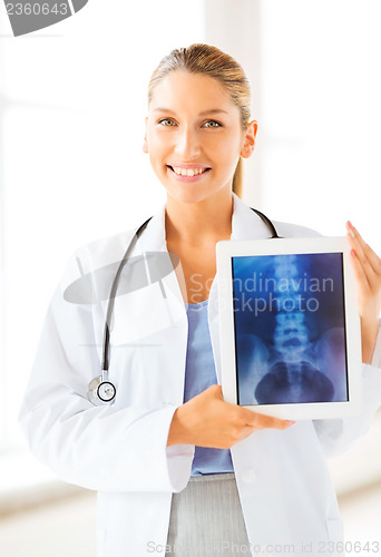 Image of female doctor with x-ray on tablet pc