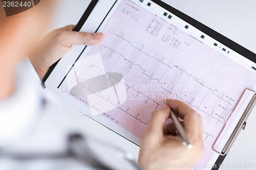 Image of male doctor hands with cardiogram