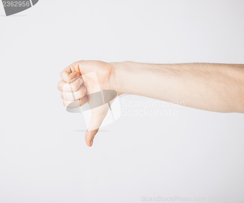 Image of man showing thumbs down