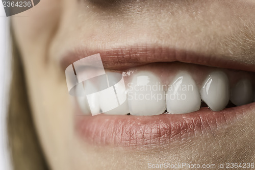 Image of Closeup white teeth of young woman