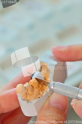 Image of hand of technician in a dental laboratory manufacturing 