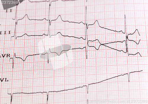 Image of  cardiogram