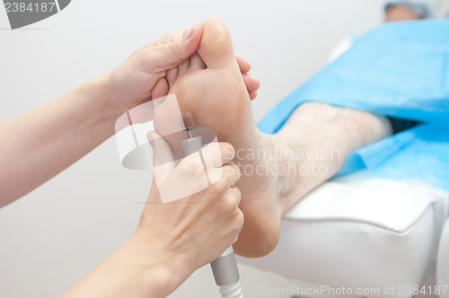 Image of foot procedure