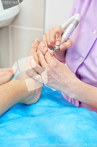 Image of foot procedure