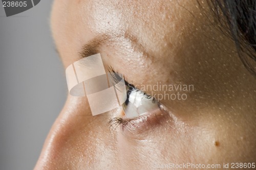 Image of  eye