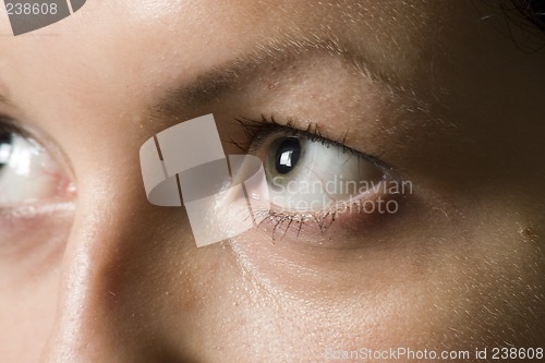 Image of  eye