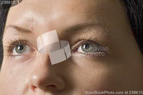 Image of  eye