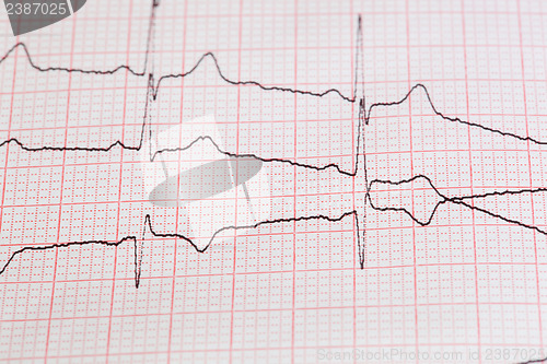 Image of cardiogram