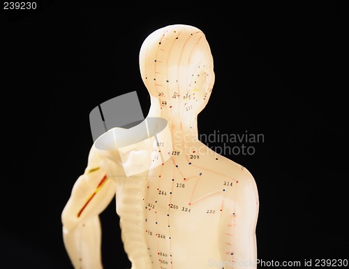 Image of acupuncture figure 3