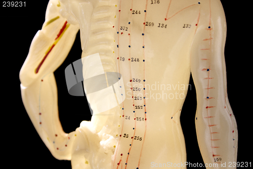 Image of acupuncture figure 2