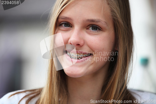 Image of Young teenage girl with orthodontic braces