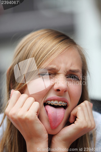 Image of Yong girl with braces sticking out her tongue